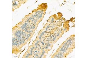 Immunohistochemistry of paraffin embedded mouse duodenum using SLC6A19 (ABIN7075682) at dilution of 1:900 (400x lens) (SLC6A19 anticorps)