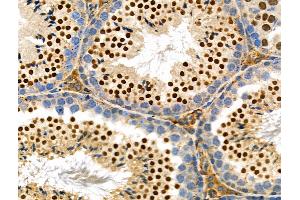 anti-SUMO1/sentrin Specific Protease 6 (SENP6) (Internal Region) antibody