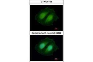 Image no. 1 for anti-COBW Domain Containing 1 (CBWD1) (AA 131-395) antibody (ABIN1497113)