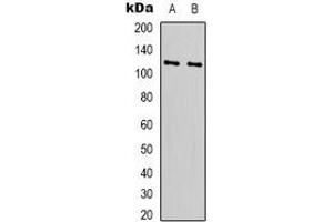 Western blot analysis of RPS6KC1 expression in Hela (A), HEK293T (B) whole cell lysates. (RPS6KC1 anticorps)