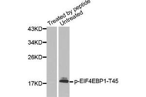 Western blot analysis of extracts from Hela cells using Phospho-EIF4EBP1-T45 antibody. (eIF4EBP1 anticorps  (pThr45))