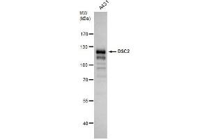 WB Image Desmocollin 2 antibody [C1C2], Internal detects Desmocollin 2 protein by western blot analysis. (Desmocollin 2 anticorps)