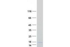 Validation with Western Blot