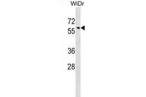 Western Blotting (WB) image for anti-Sorting Nexin 18 (SNX18) antibody (ABIN2999384) (SNX18 anticorps)