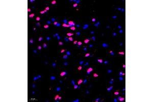 Immunofluorescence of paraffin embedded mouse spinal cord using HRP3 (ABIN7074198) at dilution of 1:2000 (400x lens)