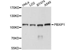 Western blot analysis of extracts of various cell lines, using PBXIP1 antibody (ABIN5996238) at 1/1000 dilution. (PBXIP1 anticorps)