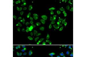 Immunofluorescence analysis of A549 cells using CARD11 Polyclonal Antibody (CARD11 anticorps)
