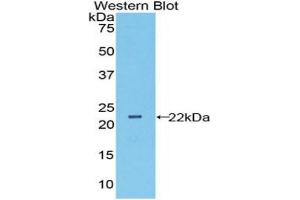 Western blot analysis of the recombinant protein. (Peroxiredoxin 6 anticorps  (AA 1-224))