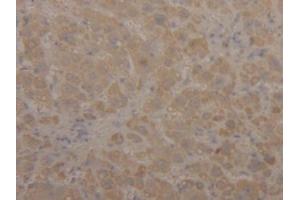 DAB staining on IHC-P; Samples: Human Liver Tissue