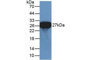 Detection of Recombinant GFP using Polyclonal Antibody to Green Fluorescent Protein (GFP) (GFP anticorps  (AA 1-238))