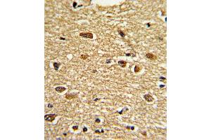 Formalin-fixed and paraffin-embedded human brain tissue reacted with ETV4 Antibody (C-term), which was peroxidase-conjugated to the secondary antibody, followed by DAB staining.