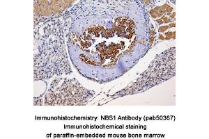 Image no. 2 for anti-NLR Family, Pyrin Domain Containing 2 (NLRP2) (Internal Region) antibody (ABIN363674) (NLRP2 anticorps  (Internal Region))