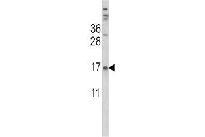 Western Blotting (WB) image for anti-Transthyretin (TTR) antibody (ABIN3002756) (TTR anticorps)