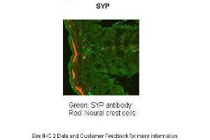 Application: Immunohistochemistry Species+tissue/cell type: Mouse Gut Tissue TgWnt1-Cre/+ Ednrbflex3/+ Rosa26YFPStop/YFPStop How many ug'sof tissue/cell lysate run on the gel: 11 m Mouse Gut Tissue Primary antibody dilution: 1:50 Secondary antibody: Goat anti-rabbit-cy3 Secondary antibody dilution: 1:1500
