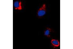 Immunofluorescent analysis of EPHB1/2 (pY594/604) staining in A431 cells.