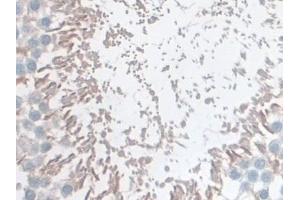 Detection of GSTm4 in Rat Testis Tissue using Polyclonal Antibody to Glutathione S Transferase Mu 4 (GSTm4)