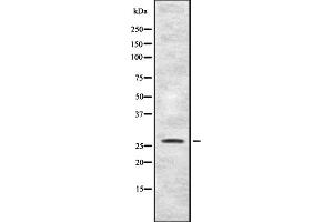 Western blot analysis of FGFP1 expression in HEK293 cells ,The lane on the left is treated with the antigen-specific peptide. (FGFBP1 anticorps  (C-Term))