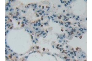 Detection of H3 in Rat Lung Tissue using Polyclonal Antibody to Histone H3 (H3)
