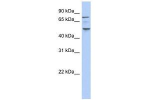 CK1 epsilon antibody used at 1 ug/ml to detect target protein.