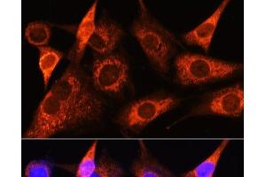 Immunofluorescence analysis of NIH-3T3 cells using PSAT1 Polyclonal Antibody at dilution of 1:100 (40x lens). (PSAT1 anticorps)