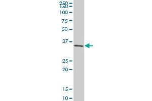 SIX3 monoclonal antibody (M01), clone 3D12 Western Blot analysis of SIX3 expression in 293 . (SIX3 anticorps  (AA 273-332))