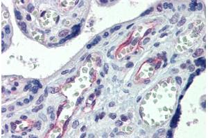 Human Placenta: Formalin-Fixed, Paraffin-Embedded (FFPE)