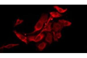 ABIN6276223 staining HepG2 by IF/ICC. (TAS2R39 anticorps  (Internal Region))