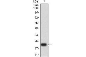 Western blot analysis using SP17 mAb against human SP17 (AA: 1-152) recombinant protein. (SPA17 anticorps  (AA 1-152))