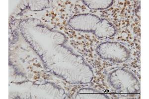 Immunoperoxidase of monoclonal antibody to CAMKK1 on formalin-fixed paraffin-embedded human stomach.