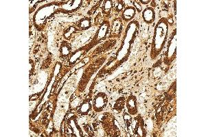 IHC analysis of SELENBP1 using anti-SELENBP1 antibody (ABIN7600755). (SELENBP1 anticorps  (AA 23-462))