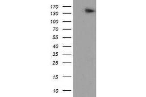 Western Blotting (WB) image for anti-ATP/GTP Binding Protein 1 (AGTPBP1) (AA 368-753) antibody (ABIN1491459) (AGTPBP1 anticorps  (AA 368-753))