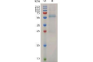 Mouse Protein, His Tag on SDS-PAGE under reducing condition.