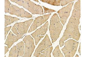 ABIN6257403 and ABIN6276254 at 1/100 staining mouse muscle tissue by IHC-P. (OR52A5 anticorps  (Internal Region))
