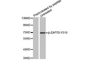 Western blot analysis of extracts from Jurkat cells, using phospho-ZAP70-Y319 antibody. (ZAP70 anticorps  (pTyr319))