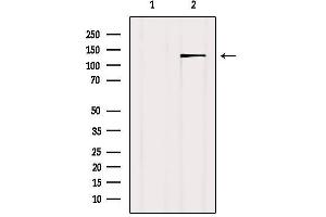 Western blot analysis of extracts from Mouse brain, using TET2 Antibody. (TET2 anticorps  (Internal Region))
