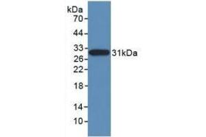 Detection of Recombinant NES, Human using Monoclonal Antibody to Nestin (NES) (Nestin anticorps  (AA 178-399))