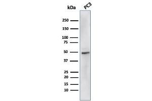 anti-Ornithine Decarboxylase 1 (ODC1) antibody