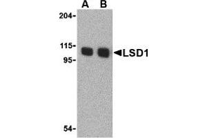 Western Blotting (WB) image for anti-Lysine (K)-Specific Demethylase 1A (KDM1A) (N-Term) antibody (ABIN1031442) (LSD1 anticorps  (N-Term))