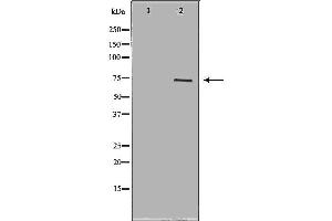 Western blot analysis of extracts of Sw626 ,using FSHR antibody. (FSHR anticorps  (Internal Region))