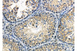 ABIN6257458 and ABIN6274126 at 1/100 staining Mouse testis tissue by IHC-P.