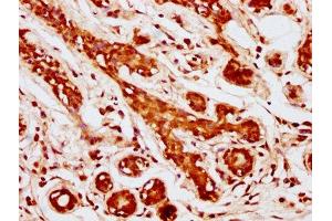 anti-MOB1, Mps One Binder Kinase Activator-Like 1B (MOBKL1B) (AA 2-216) antibody