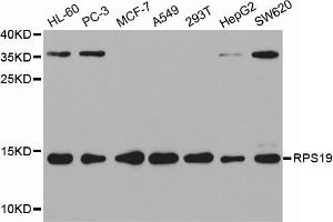 Western Blotting (WB) image for anti-Ribosomal Protein S19 (RPS19) antibody (ABIN1874653) (RPS19 anticorps)