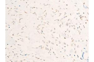 ABIN6267272 at 1/100 staining human gastric tissue sections by IHC-P.