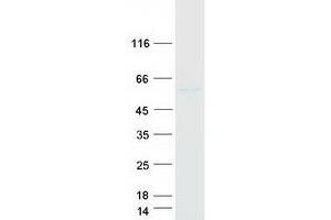 Validation with Western Blot