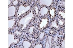 IHC analysis of PRMT5 using anti-PRMT5 antibody (ABIN7600176).