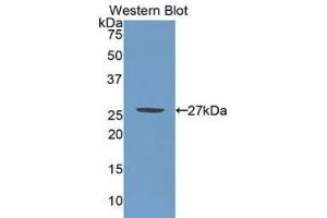 Western blot analysis of the recombinant protein. (PML anticorps  (AA 59-239))