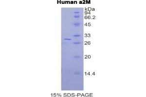 alpha-2-Macroglobulin (A2M) ELISA Kit