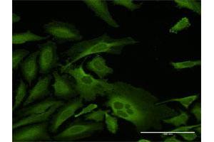 Immunofluorescence of purified MaxPab antibody to CAP1 on HeLa cell.