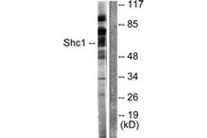 Western blot analysis of extracts from HeLa cells, treated with Calyculin A 50nM 15', using Shc (Ab-349) Antibody. (SHC1 anticorps  (AA 315-364))