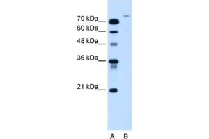 Western Blotting (WB) image for anti-Ubiquitin Specific Peptidase 48 (USP48) antibody (ABIN2463984) (USP48 anticorps)